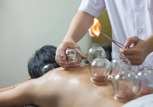 Suction cup therapy application